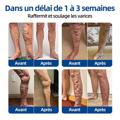 𝗛𝗲𝗮𝗹𝗿𝗶𝘇𝗲®  𝗣𝗮𝘁𝗰𝗵 𝗮̀ 𝗺𝗶𝗰𝗿𝗼-𝗮𝗶𝗴𝘂𝗶𝗹𝗹𝗲𝘀 𝗩𝗲𝗶𝗻𝗧𝗮𝗿𝗴𝗲𝘁 🌾🐳𝗦𝗼𝘂𝗹𝗮𝗴𝗲𝗺𝗲𝗻𝘁 𝗶𝗻𝘀𝘁𝗮𝗻𝘁𝗮𝗻𝗲́, 𝗿𝗲́𝘀𝘂𝗹𝘁𝗮𝘁𝘀 𝗱𝘂𝗿𝗮𝗯𝗹𝗲𝘀